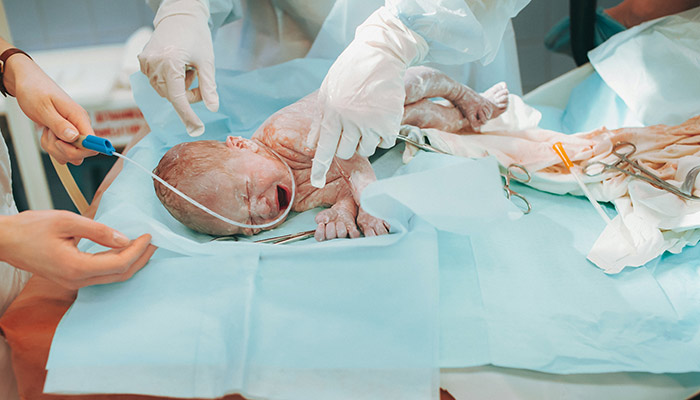 بریتیش‌کلمبیا؛ مادر بارداری که نخواسته بود واکسن کرونا بزند، نوزاد خود را در کما به دنیا آورد