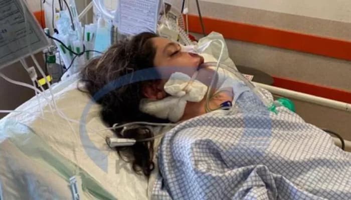 Photo of مرگ مهسا امینی پس از بازداشت توسط پلیس ایران، بازتاب گسترده‌ای در رسانه‌های امروز کانادا داشت